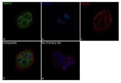 Invitrogen PRMT5 Recombinant Rabbit Monoclonal Antibody (2H25L22) 100 &mu;g;