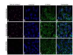 Invitrogen&trade;&nbsp;GM130 Recombinant Rabbit Monoclonal Antibody (10H5L5), Alexa Fluor&trade; Plus 647