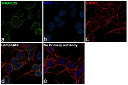 Invitrogen TMEM175 Recombinant Rabbit Monoclonal Antibody (5H18L65) 100