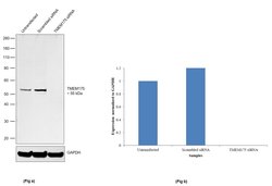 Invitrogen TMEM175 Recombinant Rabbit Monoclonal Antibody (5H18L65) 100