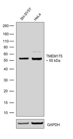 Invitrogen TMEM175 Recombinant Rabbit Monoclonal Antibody (5H18L65) 100