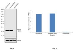 Invitrogen RAB29 Recombinant Rabbit Monoclonal Antibody (1H26L7) 100 &mu;g;