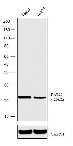 Invitrogen RAB29 Recombinant Rabbit Monoclonal Antibody (1H26L7) 100 &mu;g;