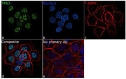 Invitrogen TP63 Recombinant Rabbit Monoclonal Antibody (10H7L17) 100 &mu;g;