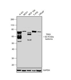 Invitrogen TP63 Recombinant Rabbit Monoclonal Antibody (10H7L17) 100 &mu;g;