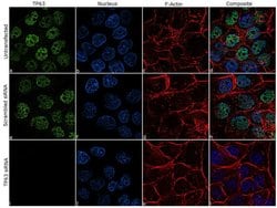 Invitrogen TP63 Recombinant Rabbit Monoclonal Antibody (10H7L17) 100 &mu;g;