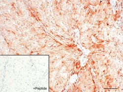 Invitrogen CALCRL Recombinant Rabbit Monoclonal Antibody (8H9L8) 100 &mu;g | Buy Online | Invitrogen&trade; | Fisher Scientific