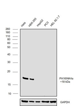 Invitrogen p16INK4a Recombinant Rabbit Monoclonal Antibody (10H23L14) 100