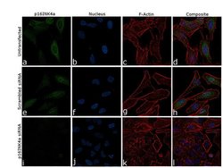 Invitrogen p16INK4a Recombinant Rabbit Monoclonal Antibody (10H23L14) 100