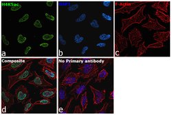 Invitrogen H4K5ac Recombinant Rabbit Monoclonal Antibody (41H60L38) 100