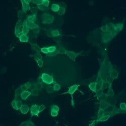 Invitrogen&trade;&nbsp;GRPR Recombinant Rabbit Monoclonal Antibody (18H31L38)