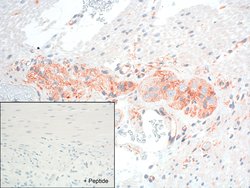 Invitrogen&trade;&nbsp;GRPR Recombinant Rabbit Monoclonal Antibody (18H31L38)