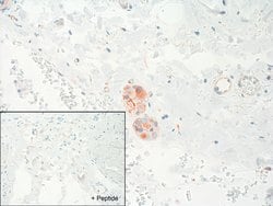 Invitrogen&trade;&nbsp;GRPR Recombinant Rabbit Monoclonal Antibody (18H31L38)