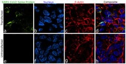 SARS-CoV-2 Spike Protein (RBD) Recombinant Human Monoclonal Antibody (T01KHu),