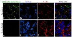 Invitrogen SARS-CoV-2 Spike Protein (RBD) Chimeric Recombinant Rabbit Monoclonal Antibody (P05DHuRb) 100 &mu;g | Buy Online | Invitrogen&trade; | Fisher Scientific