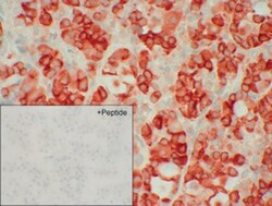 Invitrogen SSTR3 Recombinant Rabbit Monoclonal Antibody (8H32L3) 200 &mu;L;