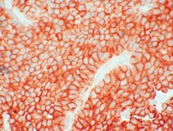 Invitrogen SSTR3 Recombinant Rabbit Monoclonal Antibody (8H32L3) 200 &mu;L;