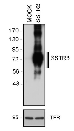 Invitrogen SSTR3 Recombinant Rabbit Monoclonal Antibody (8H32L3) 200 &mu;L;