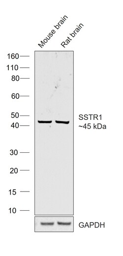 Invitrogen SSTR1 Recombinant Rabbit Monoclonal Antibody (18H22L9) 200 &mu;L | Buy Online | Invitrogen&trade; | Fisher Scientific
