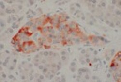 Invitrogen SSTR1 Recombinant Rabbit Monoclonal Antibody (18H22L9) 200 &mu;L | Buy Online | Invitrogen&trade; | Fisher Scientific