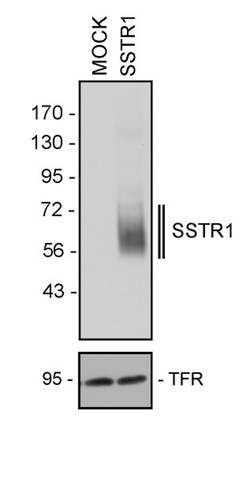 Invitrogen SSTR1 Recombinant Rabbit Monoclonal Antibody (18H22L9) 200 &mu;L | Buy Online | Invitrogen&trade; | Fisher Scientific