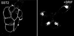 Invitrogen SSTR2 Recombinant Rabbit Monoclonal Antibody (11H21L13) 100