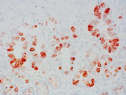 Invitrogen SSTR2 Recombinant Rabbit Monoclonal Antibody (11H21L13) 100