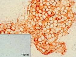 Invitrogen SSTR2 Recombinant Rabbit Monoclonal Antibody (11H21L13) 100