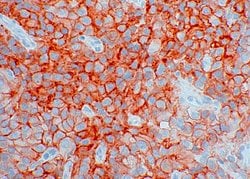 Invitrogen SSTR2 Recombinant Rabbit Monoclonal Antibody (11H21L13) 100