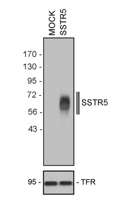 Invitrogen SSTR5 Recombinant Rabbit Monoclonal Antibody (19H17L5) 100 &mu;g;