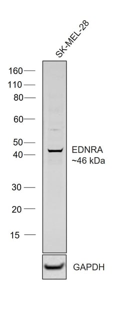 Endothelin A Receptor Recombinant Rabbit Monoclonal Antibody (15H24L16),