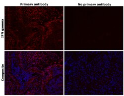 Invitrogen IFN gamma Recombinant Rabbit Monoclonal Antibody (R3P1-E3) 100 &mu;L | Buy Online | Invitrogen&trade; | Fisher Scientific