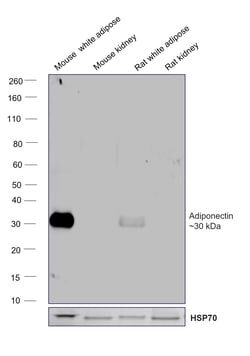Invitrogen Adiponectin Recombinant Rabbit Monoclonal Antibody (8H25L59) 100 &mu;L | Buy Online | Invitrogen&trade; | Fisher Scientific