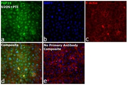 Invitrogen&trade;&nbsp;FGF23 Recombinant Rabbit Monoclonal Antibody (20H20L38)