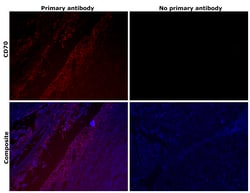 Invitrogen CD70 Recombinant Rabbit Monoclonal Antibody (CD70-Clone 13) 100 &mu;L | Buy Online | Invitrogen&trade; | Fisher Scientific
