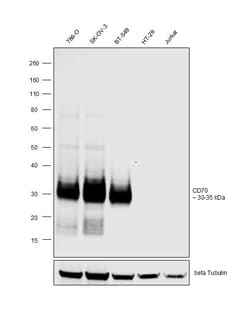 Invitrogen CD70 Recombinant Rabbit Monoclonal Antibody (CD70-Clone 13) 100 &mu;L | Buy Online | Invitrogen&trade; | Fisher Scientific