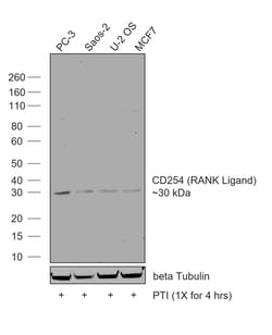 Invitrogen&trade;&nbsp;CD254 (RANK Ligand) Recombinant Rabbit Monoclonal Antibody (CD254-Clone 99)