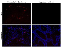 Invitrogen IL-6 Recombinant Rabbit Monoclonal Antibody (54H58L14) 100 &mu;L | Buy Online | Invitrogen&trade; | Fisher Scientific