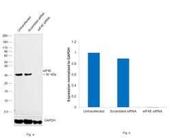 Invitrogen eIF4E Recombinant Rabbit Monoclonal Antibody (eIF4E-Clone 155) 100 &mu;L | Buy Online | Invitrogen&trade; | Fisher Scientific