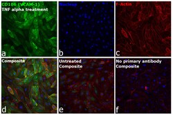 Invitrogen CD106 (VCAM-1) Recombinant Rabbit Monoclonal Antibody (45H17L57) 20 &mu;L | Buy Online | Invitrogen&trade; | Fisher Scientific
