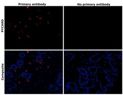 Invitrogen PYCARD Recombinant Rabbit Monoclonal Antibody (D6) 100 &mu;L | Buy Online | Invitrogen&trade; | Fisher Scientific