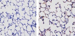 Invitrogen CCL5 (RANTES) Recombinant Superclonal Antibody (25HCLC) 100