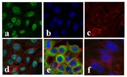 NFkB p65 Recombinant Polyclonal Antibody (4-2HCLC), Invitrogen 100 &mu;g;
