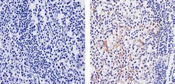 Invitrogen CCL3 Recombinant Superclonal Antibody (1HCLC) 100 &mu;g; Unconjugated:Antibodies,