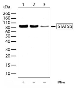 STAT5 beta Recombinant Superclonal Antibody (13HCLC):Antibodies, Recombinant