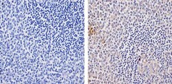 Invitrogen TLR4 Recombinant Superclonal Antibody (20HCLC) 100 &mu;g; Unconjugated:Anticuerpos