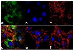 Invitrogen FABP4 Recombinant Superclonal Antibody (2HCLC) 100 &mu;g; Unconjugated:Antibodies,