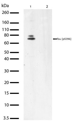 Phospho-Tau (Ser396) Recombinant Polyclonal Antibody (5HCLC), Invitrogen&trade;