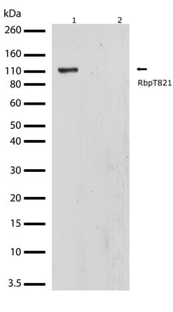 Invitrogen Phospho-Rb (Thr821) Recombinant Superclonal Antibody (16HCLC) 100 &mu;g | Buy Online | Invitrogen&trade; | Fisher Scientific