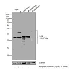 Invitrogen&trade;&nbsp;IL-1 beta Recombinant Superclonal&trade; Antibody (17HCLC)